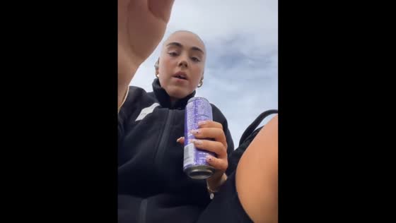 Tooth breaks during attempt to open can with mouth in North Jutland, Denmark