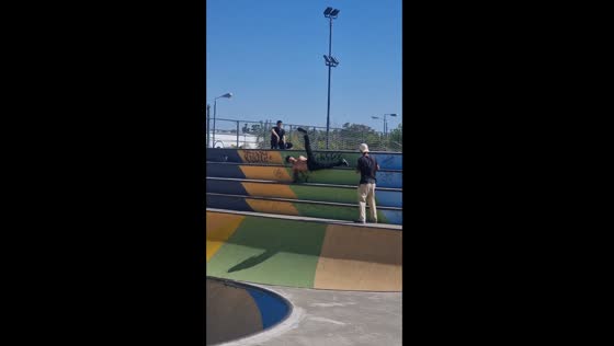 Skateboard flip fail results in a hospital trip