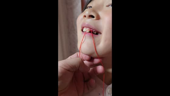 Girl bravely pulls out her own tooth using a door in Shandong, China