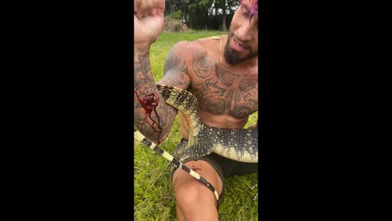 Monitor lizard bite: close encounter in Hollywood, Florida
