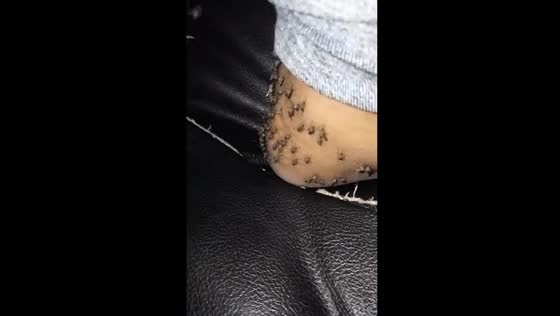 Close encounter: unfazed resident captures swarming mosquitoes on camera