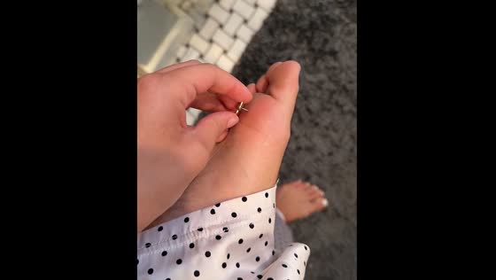Person removes starfish-shaped earring from foot in San Diego