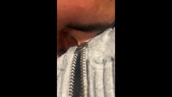 Sister gets eyelid stuck in zipper