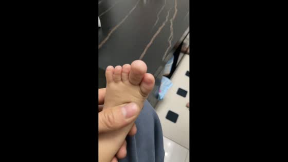 Baby’s unusually enlarged toe draws attention in Ningxia, China