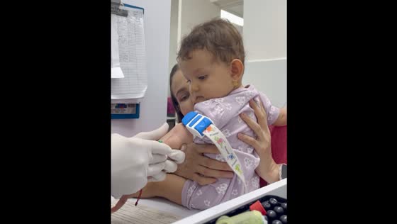 Baby stays calm during blood draw in Medellin