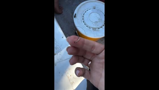 Fishing mishap leaves woman with hooked finger in Entre Ríos, Argentina