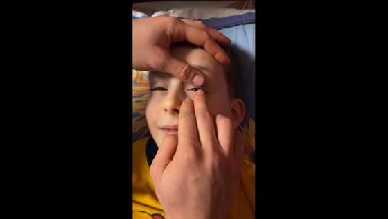 Child calmly has prosthetic eye removed in Moscow, Russia