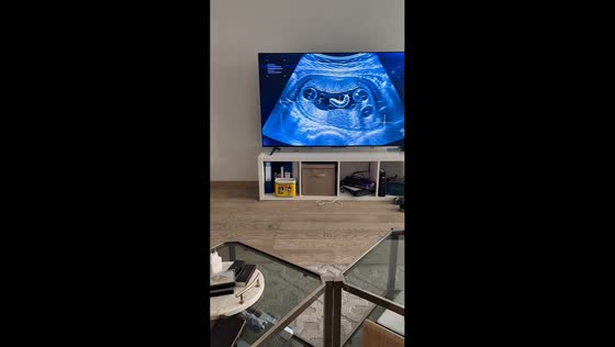 Boy gets scared by pretend ultrasound prank in Brussels, Belgium