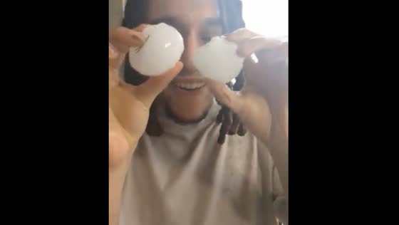Massive hailstones highlight Texas storm