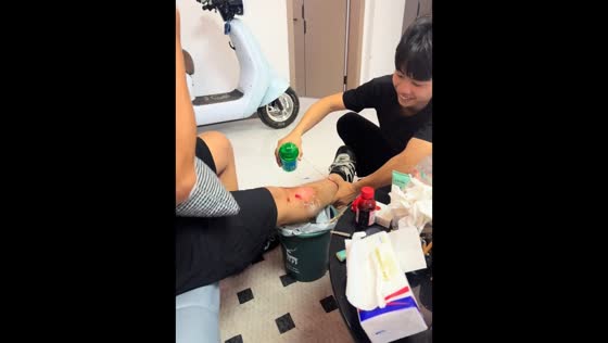 Man reacts dramatically while friend treats leg wounds in Shandong, China