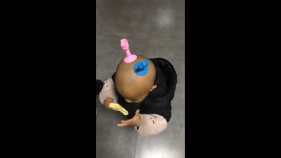 Child reacts to suction cup toys on head in Anhui, China