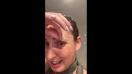 Eyebrow nearly peeled off during face mask removal in Granada, Spain