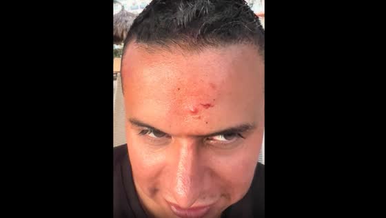 Epic fail! Drone crashing to man's face