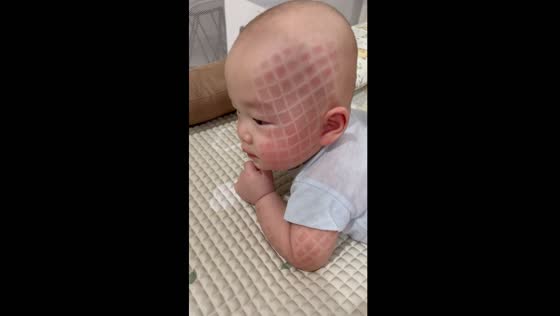 6-month-old baby sports box imprints after nap: mom finds it amusing