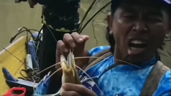 A man got pinched by a giant shrimp on his lip!