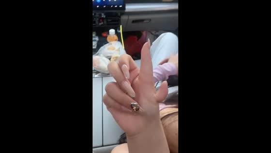 Girl shows friend her hand with an extra finger in Guangdong, China