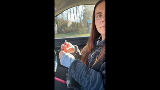 Woman startled as lip peptides burst open in Manchester, England, UK