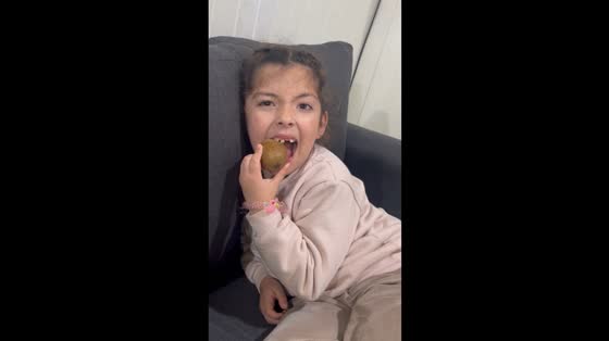 Girl loses tooth while biting kiwi in Buenos Aires