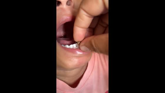 Toddler struggles with object stuck in mouth in Ulugalung, Sulawesi, Indonesia