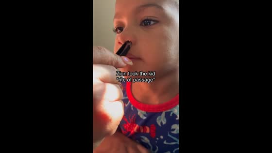 Mother helps remove tiny toy from boy’s nose in Charlotte, North Carolina, USA
